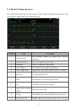 Preview for 26 page of ECGMAC VET-301 User Manual