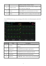 Preview for 27 page of ECGMAC VET-301 User Manual