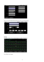 Preview for 41 page of ECGMAC VET-301 User Manual