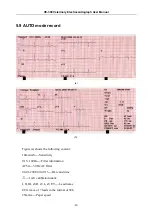 Preview for 47 page of Edan Instruments, Inc. VE-300 User Manual