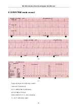 Preview for 49 page of Edan Instruments, Inc. VE-300 User Manual