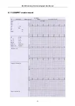 Preview for 51 page of Edan Instruments, Inc. VE-300 User Manual