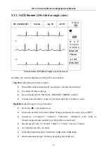 Предварительный просмотр 17 страницы EDAN INSTRUMENTS SE-3 User Manual