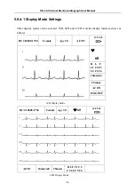 Предварительный просмотр 49 страницы EDAN INSTRUMENTS SE-3 User Manual