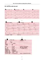 Предварительный просмотр 53 страницы EDAN INSTRUMENTS SE-3 User Manual