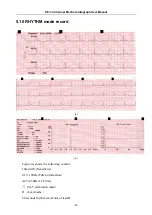 Preview for 55 page of EDAN INSTRUMENTS SE-3 User Manual