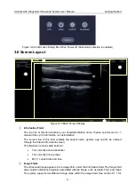 Preview for 27 page of EDAN Acclarix AX4 User Manual