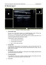 Предварительный просмотр 30 страницы EDAN Acclarix LX4 User Manual