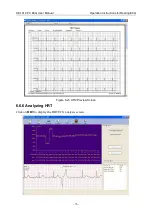 Preview for 85 page of EDAN SE-101 User Manual