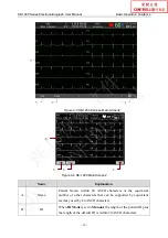 Preview for 47 page of EDAN SE-1200 Series User Manual