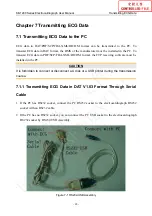 Preview for 73 page of EDAN SE-1200 Series User Manual