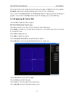 Предварительный просмотр 74 страницы EDAN SE-1515 User Manual