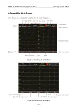 Предварительный просмотр 36 страницы EDAN SE-601 Series User Manual