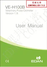 EDAN VE-H100B User Manual предпросмотр