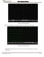 Предварительный просмотр 28 страницы eHealthcare Ai1 Operation Manual