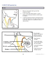 Предварительный просмотр 12 страницы ElectroCore gammaCore-S Instruction Manual