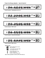 Preview for 11 page of Engl Fireball 100 Operating Manual