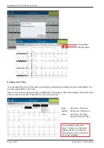 Предварительный просмотр 70 страницы ERT SpiroSphere Instructions For Use Manual