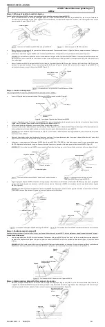 Предварительный просмотр 10 страницы Essential Medical Supply MANTA Instructions For Use Manual