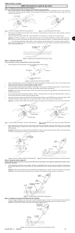 Предварительный просмотр 13 страницы Essential Medical Supply MANTA Instructions For Use Manual