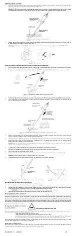 Предварительный просмотр 14 страницы Essential Medical Supply MANTA Instructions For Use Manual