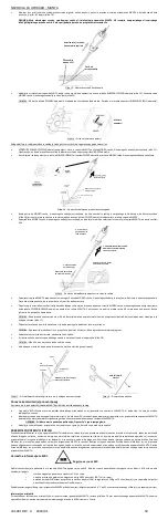 Предварительный просмотр 50 страницы Essential Medical Supply MANTA Instructions For Use Manual