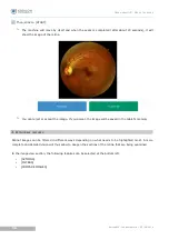 Предварительный просмотр 35 страницы Essilor Instruments Retina 800 User Manual