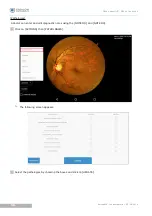 Предварительный просмотр 37 страницы Essilor Instruments Retina 800 User Manual