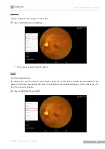 Предварительный просмотр 38 страницы Essilor Instruments Retina 800 User Manual