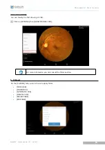 Предварительный просмотр 50 страницы Essilor Instruments Retina 800 User Manual