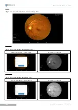 Предварительный просмотр 51 страницы Essilor Instruments Retina 800 User Manual