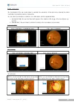 Предварительный просмотр 52 страницы Essilor Instruments Retina 800 User Manual