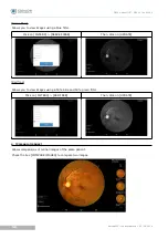 Предварительный просмотр 55 страницы Essilor Instruments Retina 800 User Manual