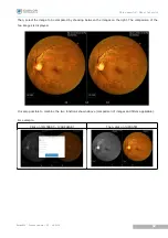 Предварительный просмотр 56 страницы Essilor Instruments Retina 800 User Manual