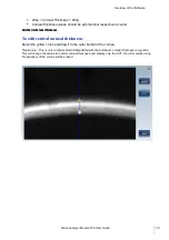 Preview for 75 page of Essilor Medica 700 User Manual