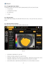 Preview for 67 page of Essilor MYOPIA EXPERT 700 User Manual