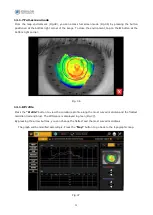 Preview for 73 page of Essilor MYOPIA EXPERT 700 User Manual