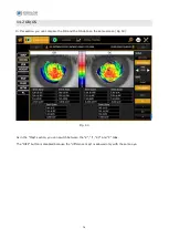 Preview for 76 page of Essilor MYOPIA EXPERT 700 User Manual