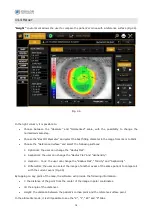 Preview for 80 page of Essilor MYOPIA EXPERT 700 User Manual