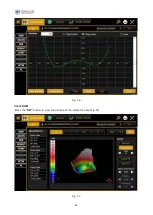 Preview for 82 page of Essilor MYOPIA EXPERT 700 User Manual