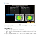 Preview for 84 page of Essilor MYOPIA EXPERT 700 User Manual