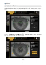 Preview for 91 page of Essilor MYOPIA EXPERT 700 User Manual