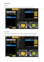 Preview for 122 page of Essilor MYOPIA EXPERT 700 User Manual