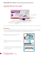 Ethicon DERMABOND PRINEO Application Manual preview