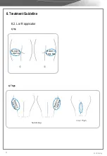 Предварительный просмотр 46 страницы EunSung CoolShaping Operator'S Manual