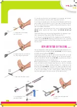 Preview for 4 page of FH ORTHOPEDICS be POD TYLOS Arthrodese-Nail Manual