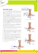 Preview for 5 page of FH ORTHOPEDICS be POD TYLOS Arthrodese-Nail Manual