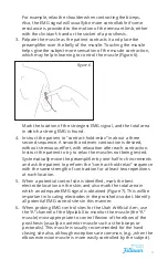 Preview for 9 page of Fillauer Myolab II Prosthetist Manual