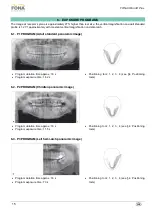 Предварительный просмотр 15 страницы Fona XPan 3D Plus Operating Instructions Manual