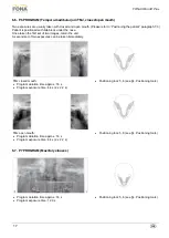 Предварительный просмотр 17 страницы Fona XPan 3D Plus Operating Instructions Manual